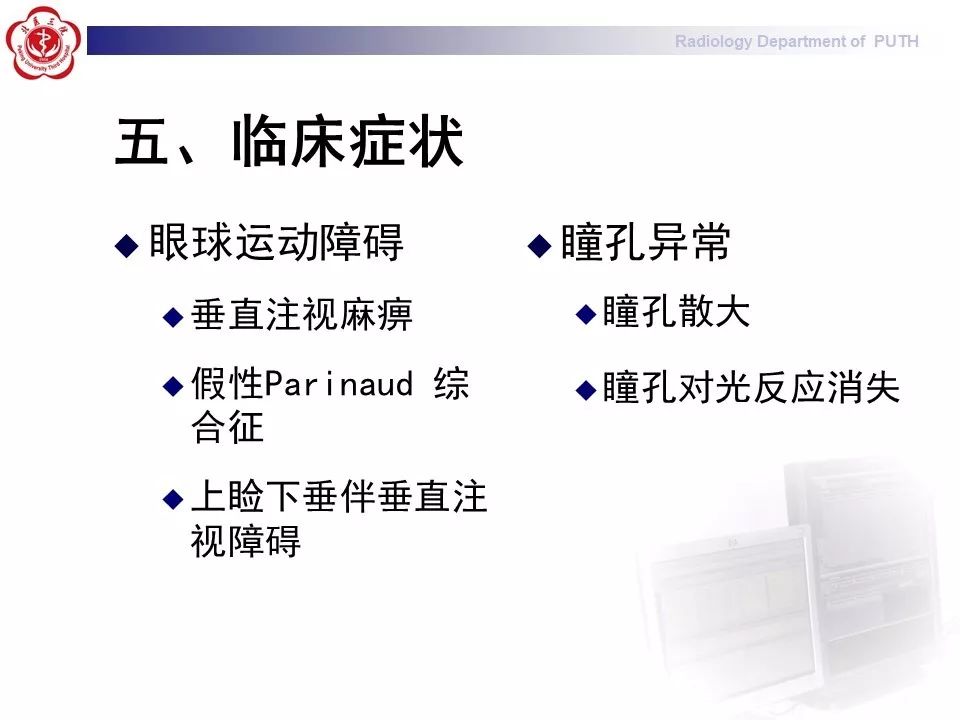 【病例】基底动脉尖综合征1例MR