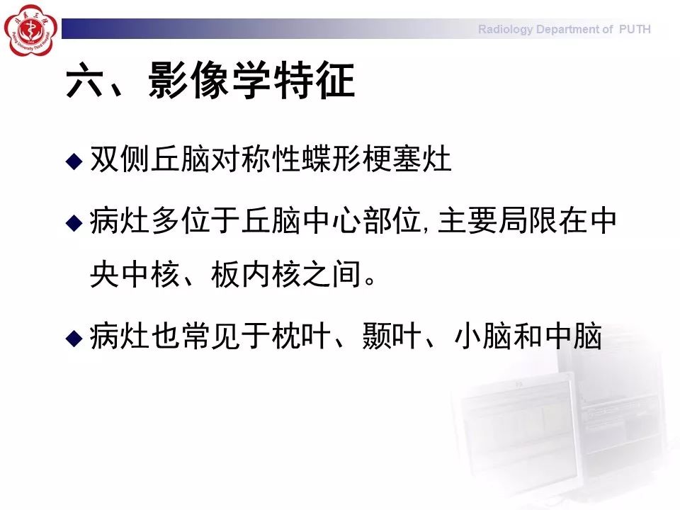 【病例】基底动脉尖综合征1例MR