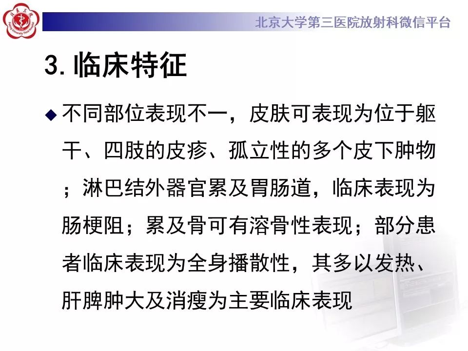 【病例】肺部组织细胞肉瘤例CT