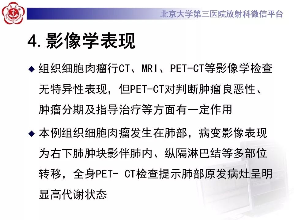【病例】肺部组织细胞肉瘤例CT