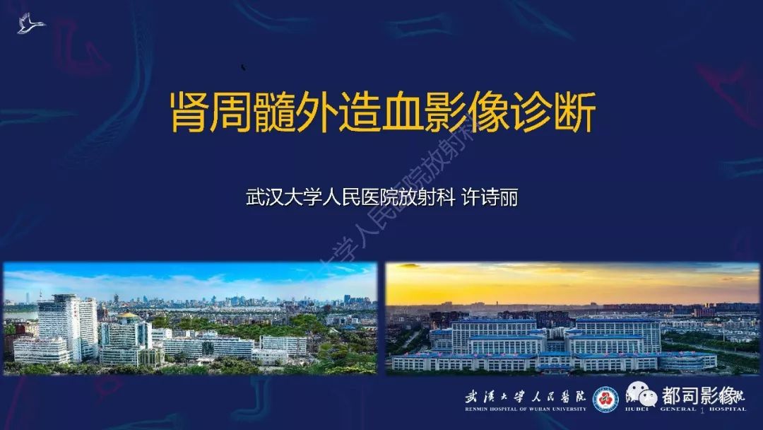 【PPT】肾周髓外造血影像诊断