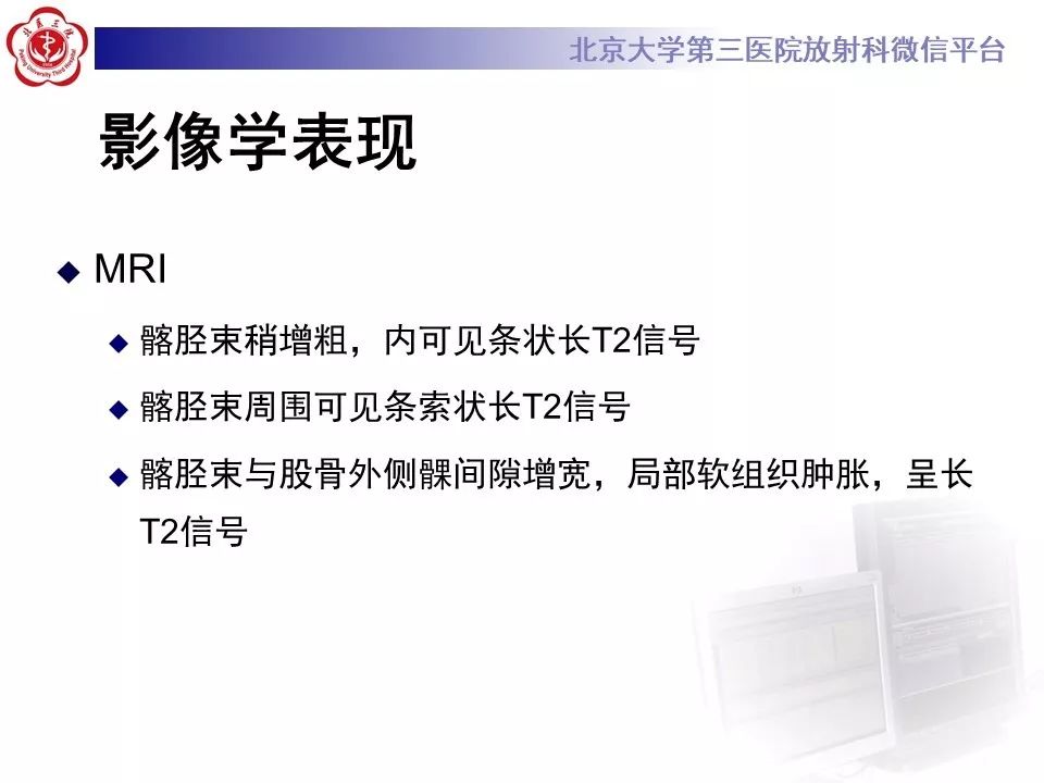【病例】髂胫束综合征1例MR