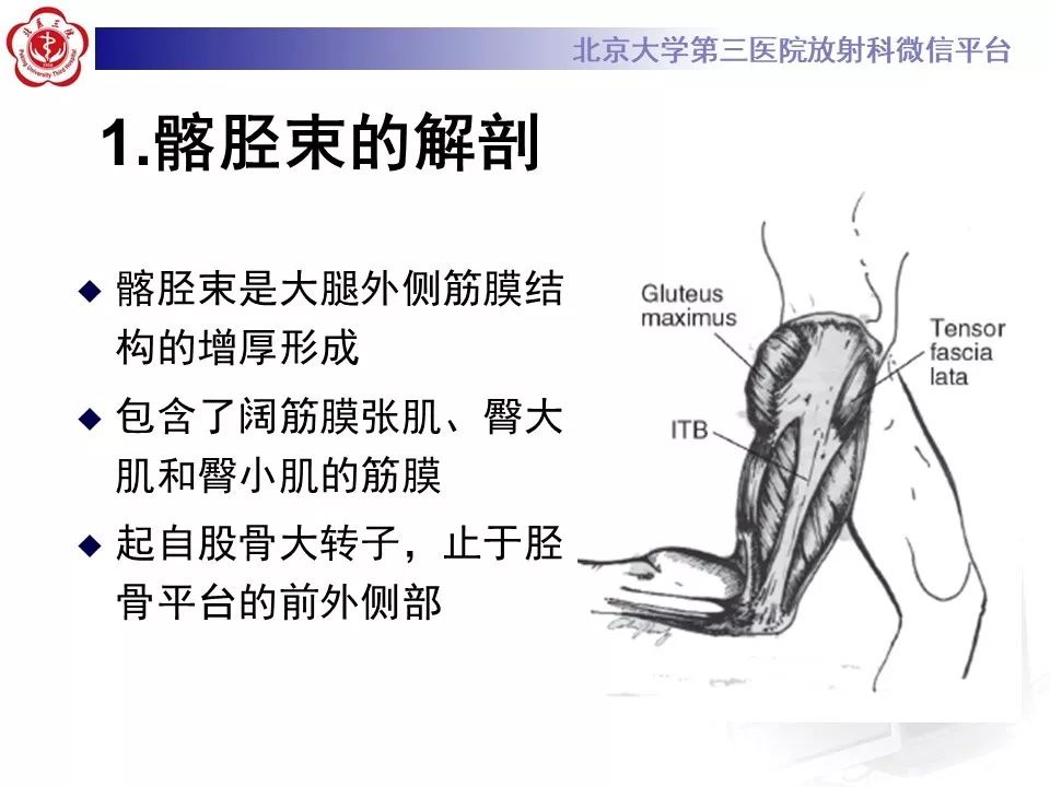 【病例】髂胫束综合征1例MR