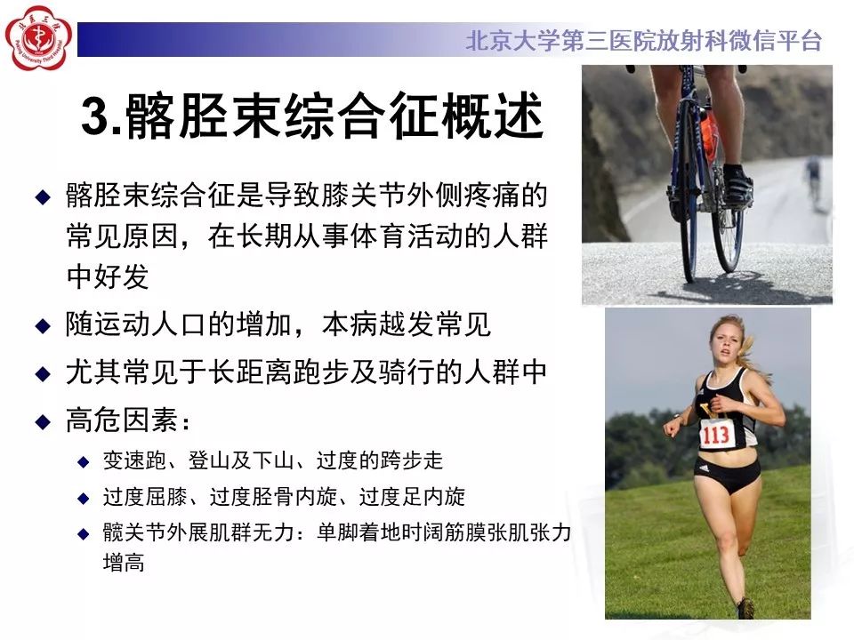 【病例】髂胫束综合征1例MR