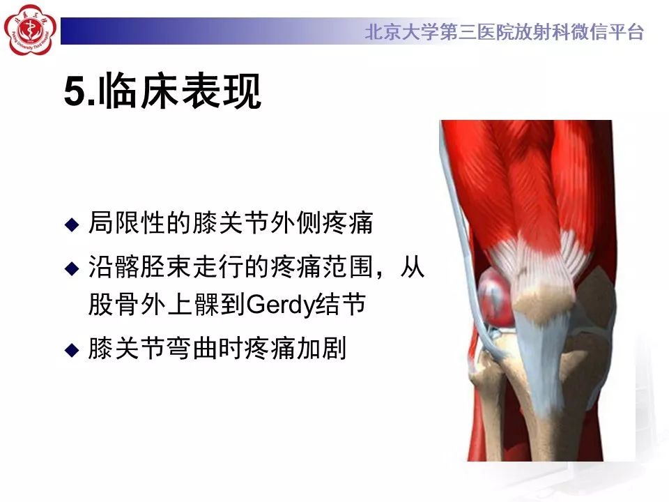 【病例】髂胫束综合征1例MR