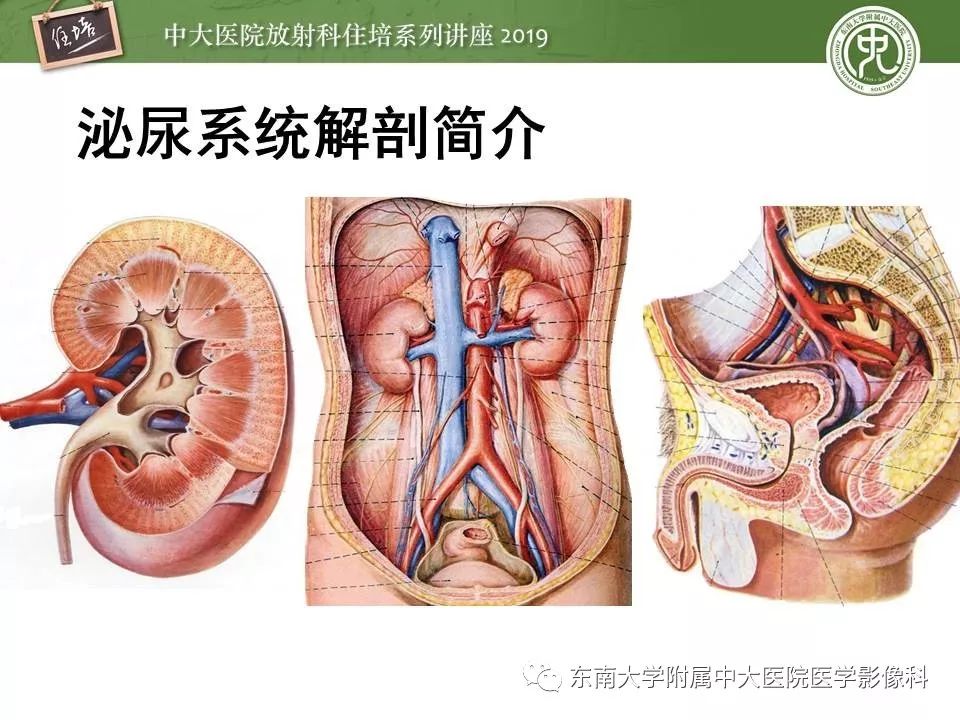 【PPT】血尿的影像分析思路