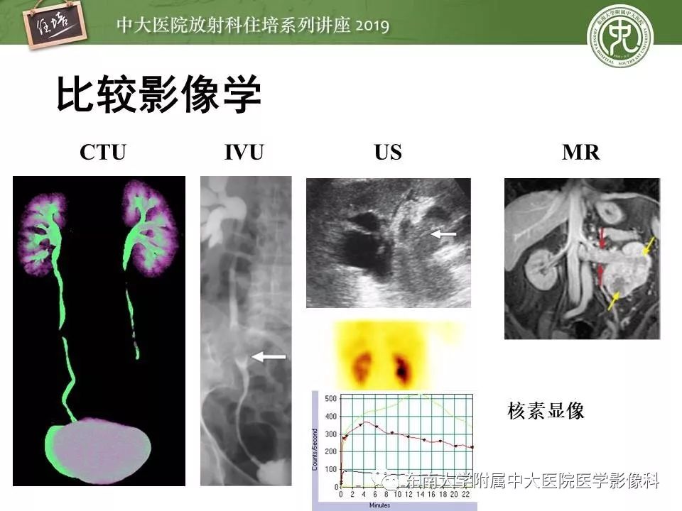 【PPT】血尿的影像分析思路