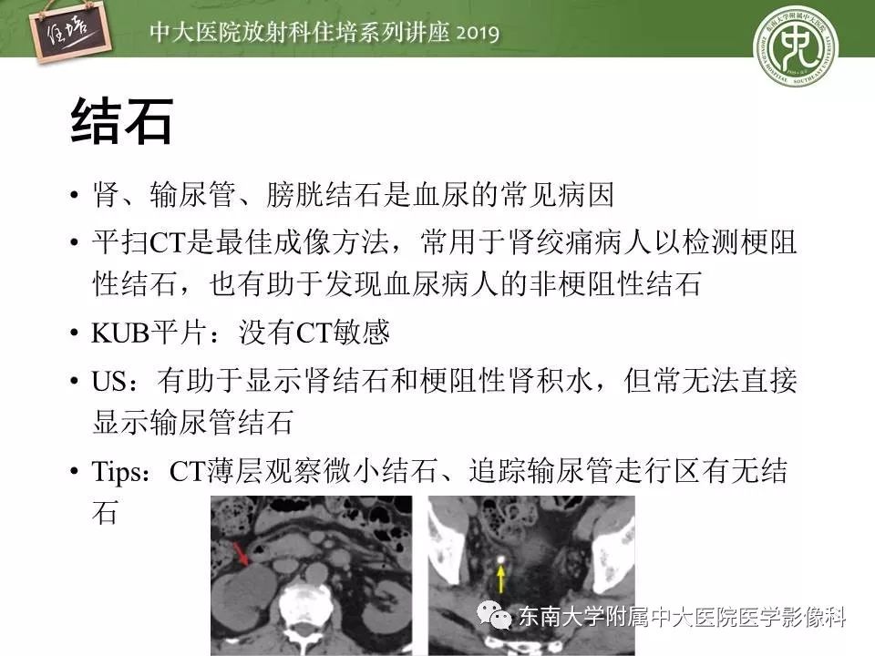 【PPT】血尿的影像分析思路