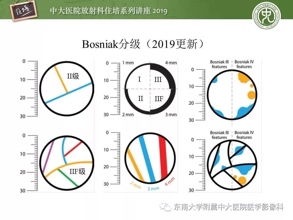 【PPT】血尿的影像分析思路