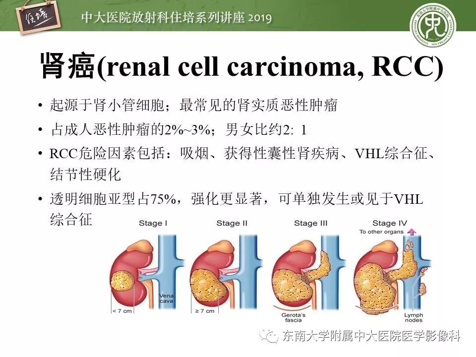 【PPT】血尿的影像分析思路