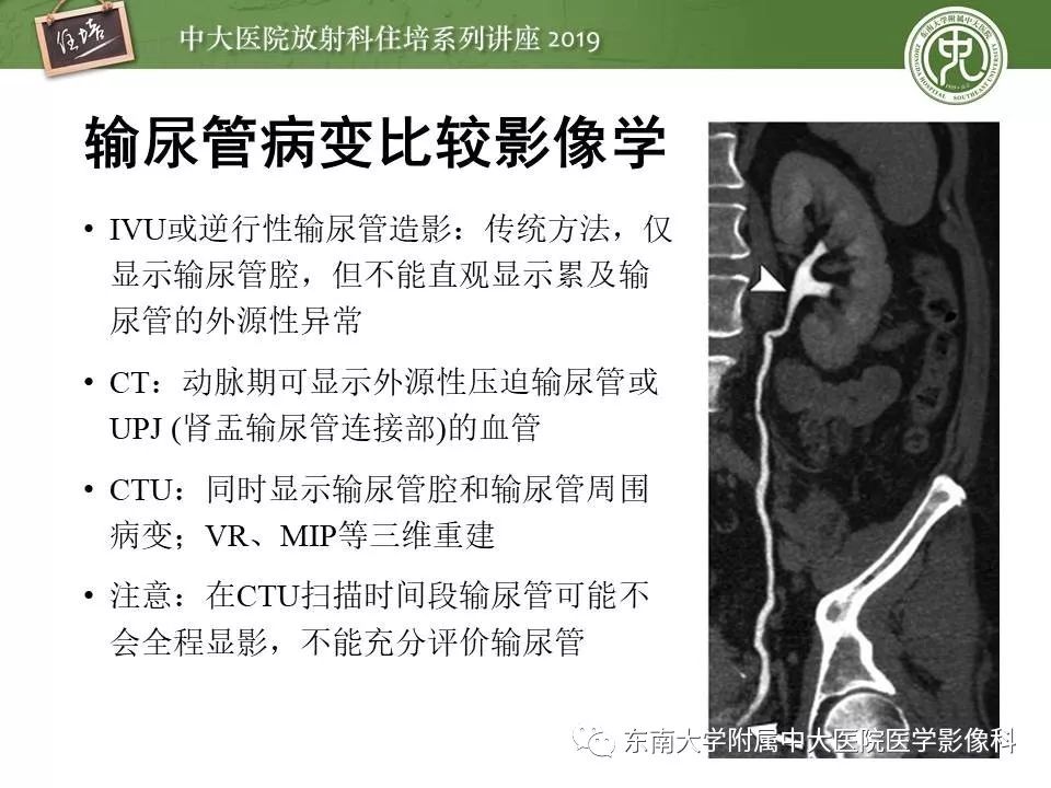 【PPT】血尿的影像分析思路