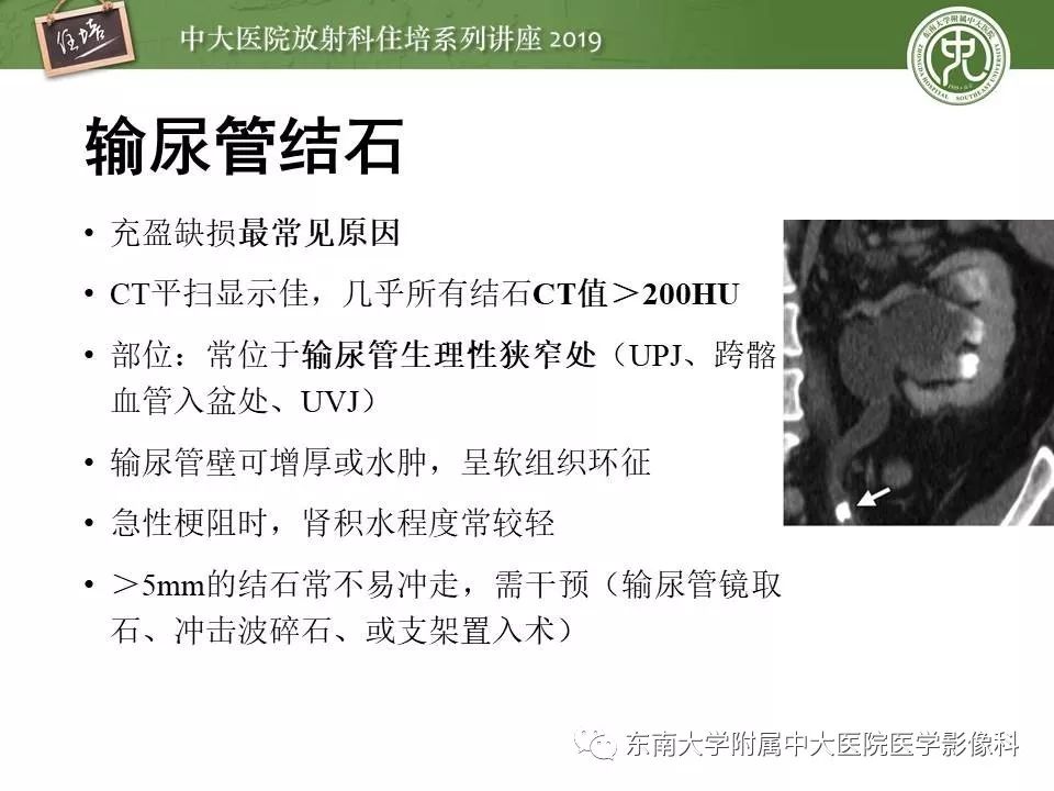 【PPT】血尿的影像分析思路