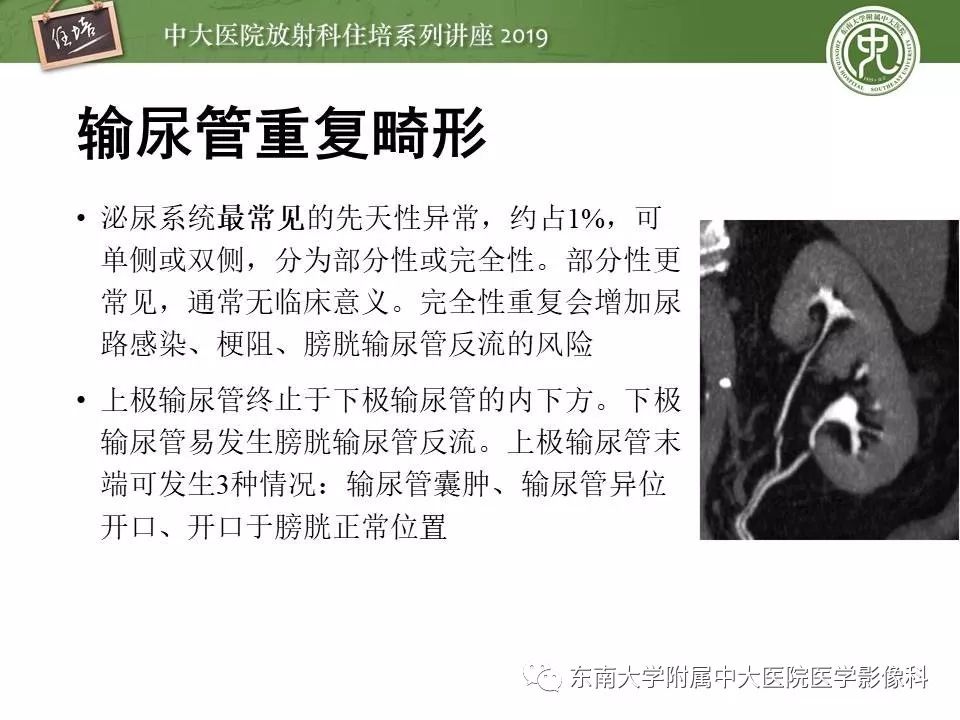 【PPT】血尿的影像分析思路