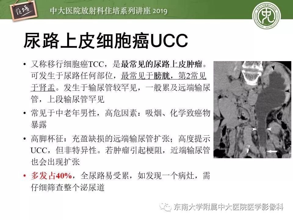 【PPT】血尿的影像分析思路