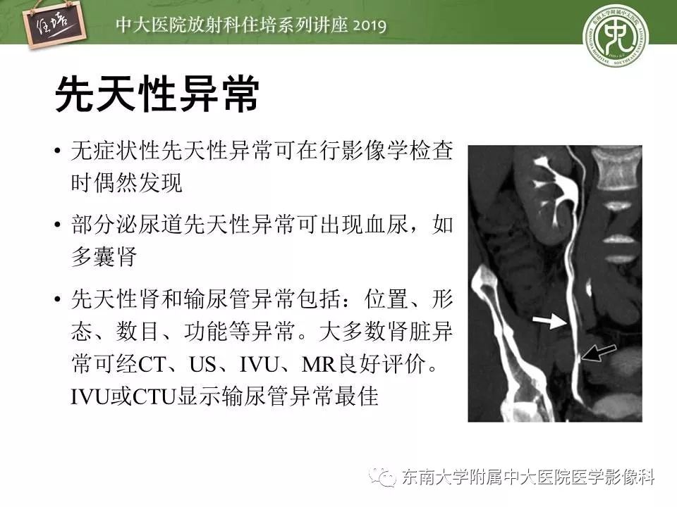 【PPT】血尿的影像分析思路