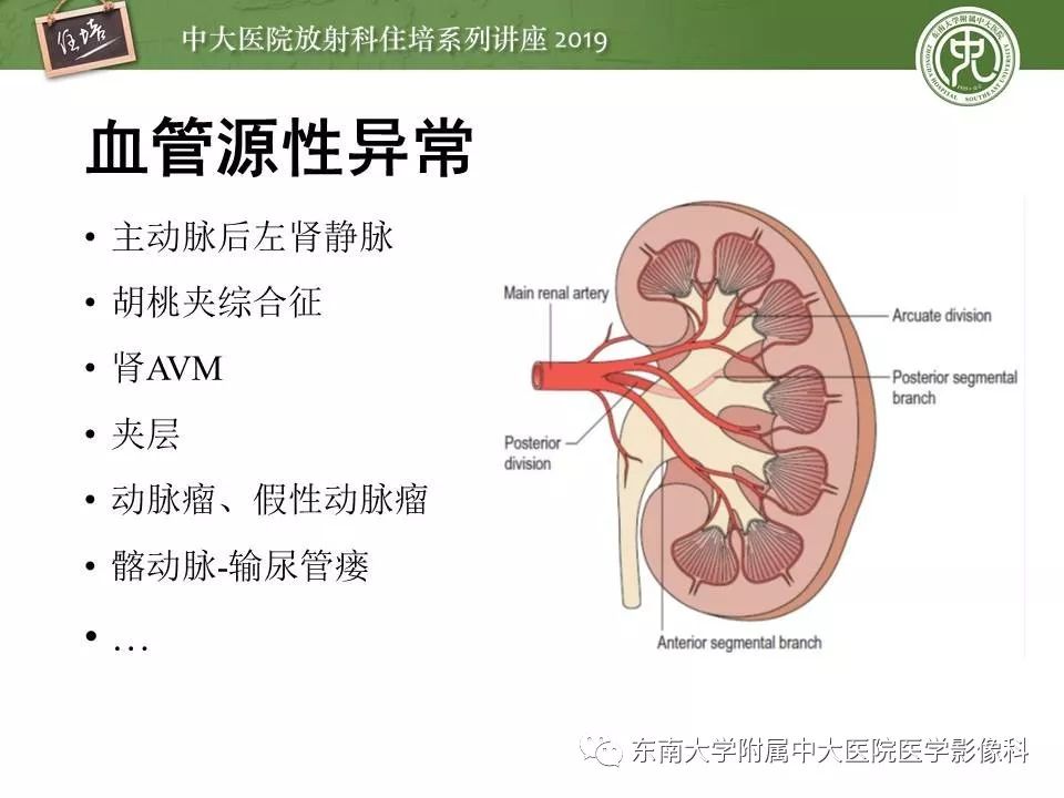 【PPT】血尿的影像分析思路
