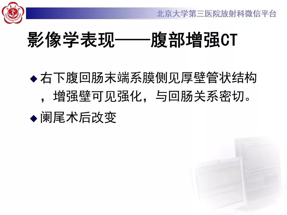 【病例】回肠重复畸形1例CT影像