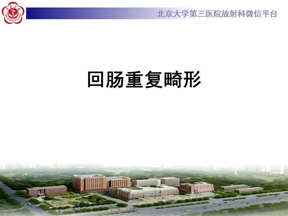 【病例】回肠重复畸形1例CT影像