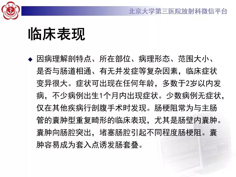 【病例】回肠重复畸形1例CT影像