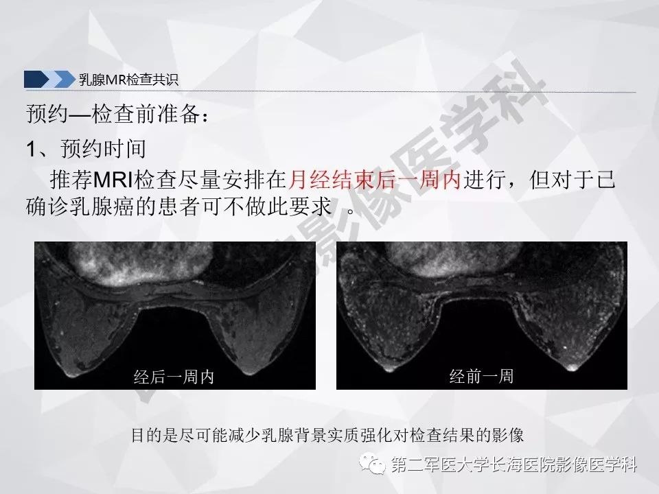 【PPT】乳腺MR规范检查及诊断