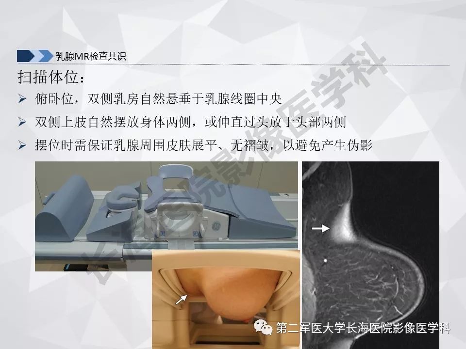 【PPT】乳腺MR规范检查及诊断