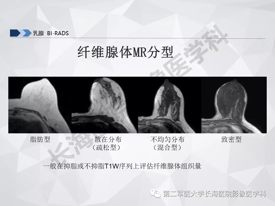 【PPT】乳腺MR规范检查及诊断