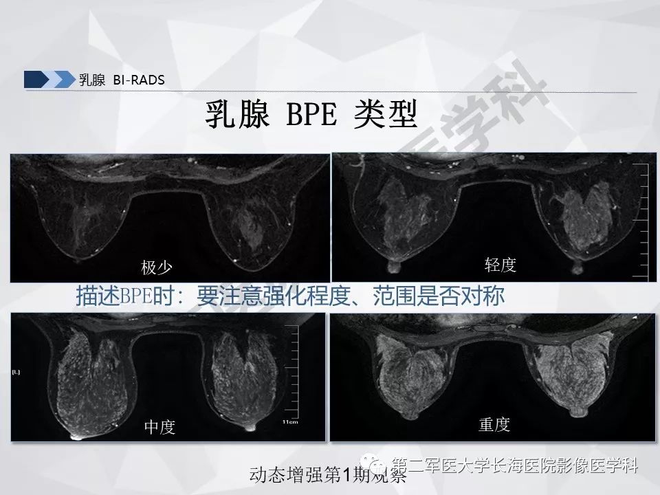 【PPT】乳腺MR规范检查及诊断