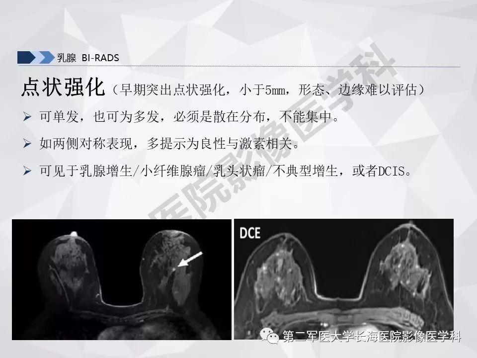 【PPT】乳腺MR规范检查及诊断