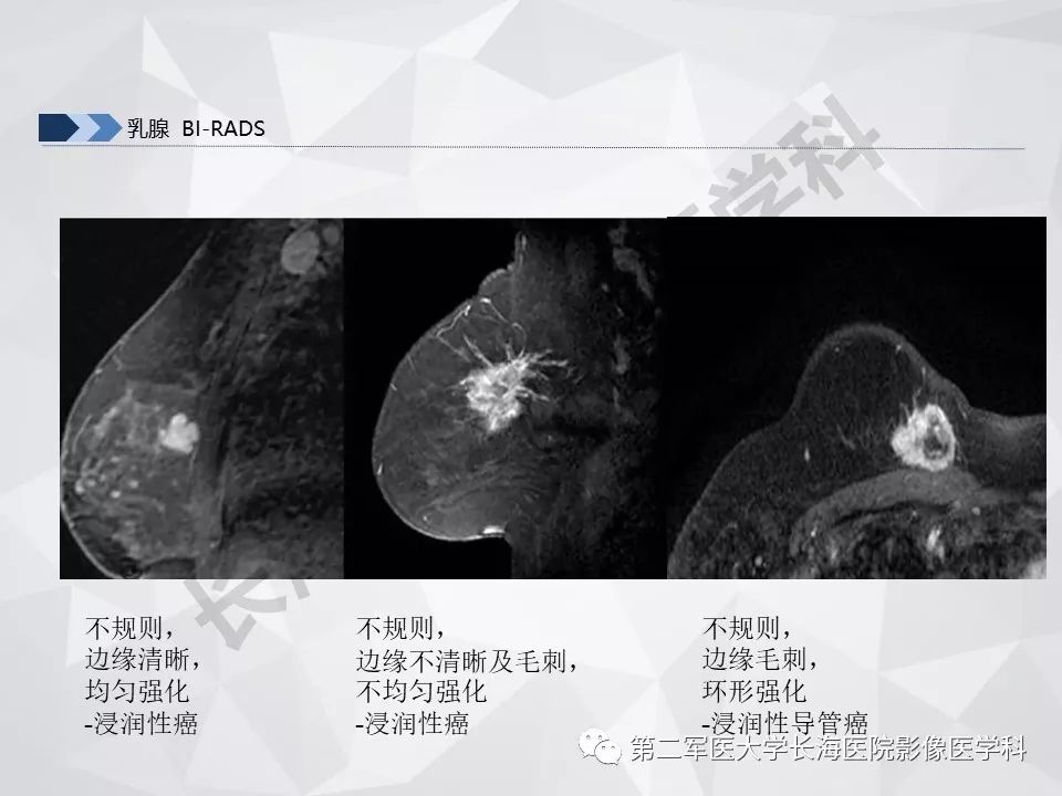 【PPT】乳腺MR规范检查及诊断