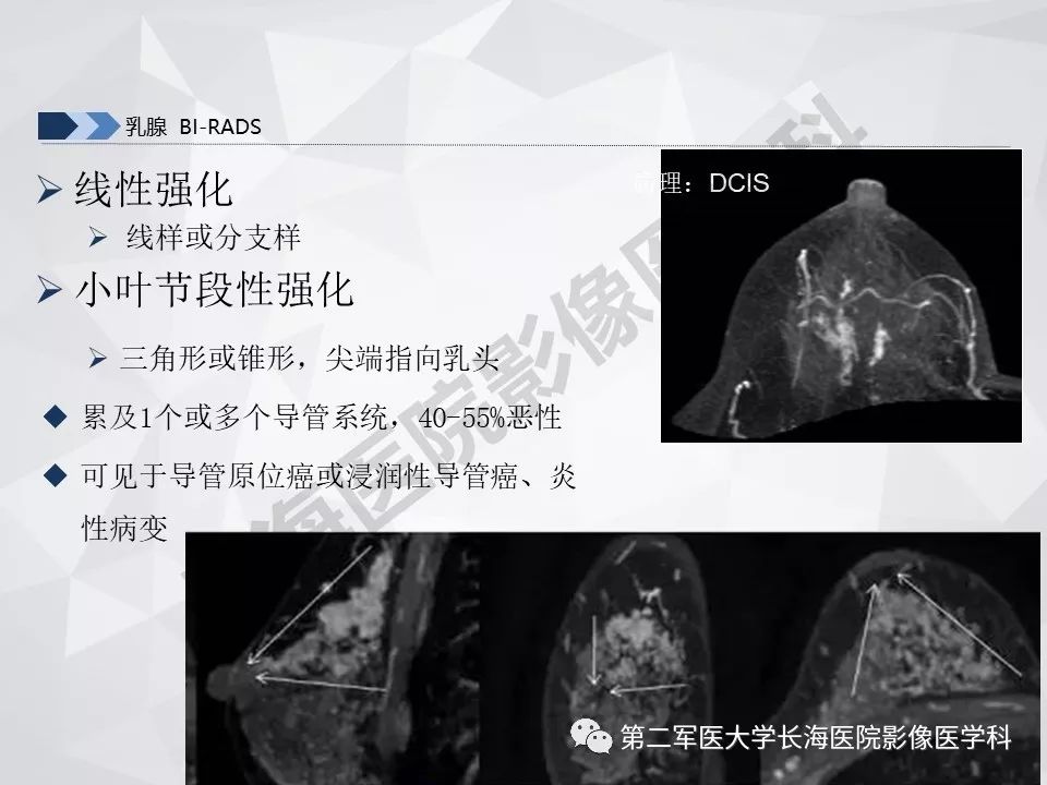【PPT】乳腺MR规范检查及诊断