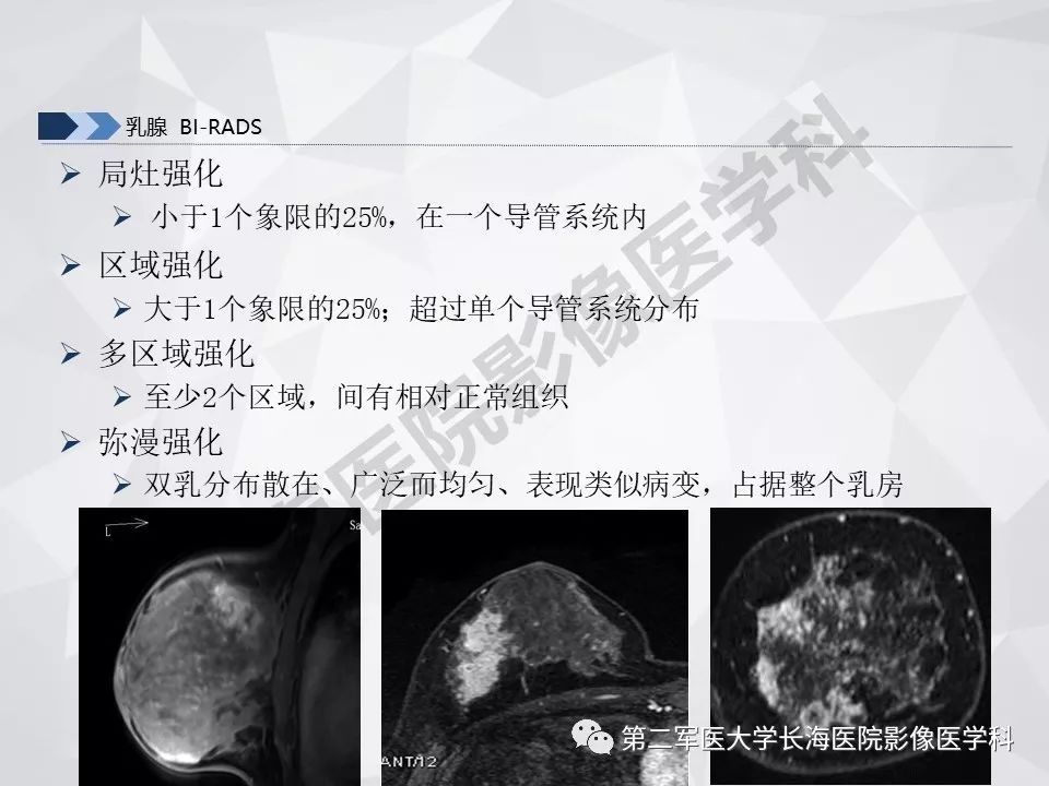 【PPT】乳腺MR规范检查及诊断