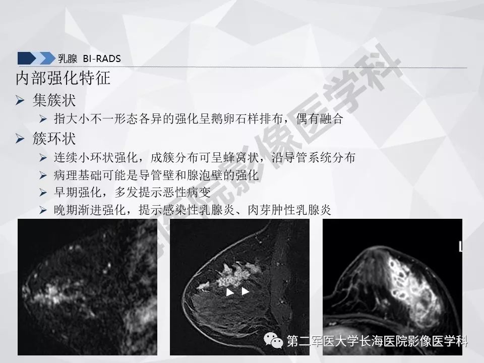 【PPT】乳腺MR规范检查及诊断