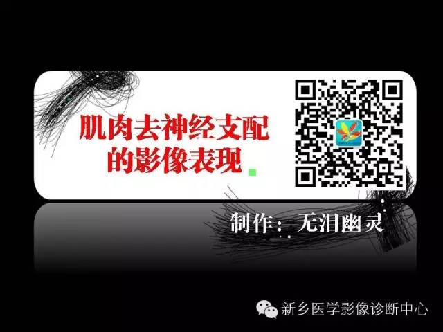 【PPT】肌肉去神经支配的影像表现
