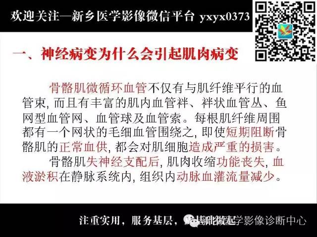 【PPT】肌肉去神经支配的影像表现