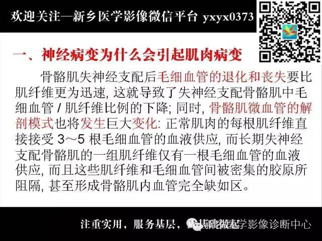 【PPT】肌肉去神经支配的影像表现
