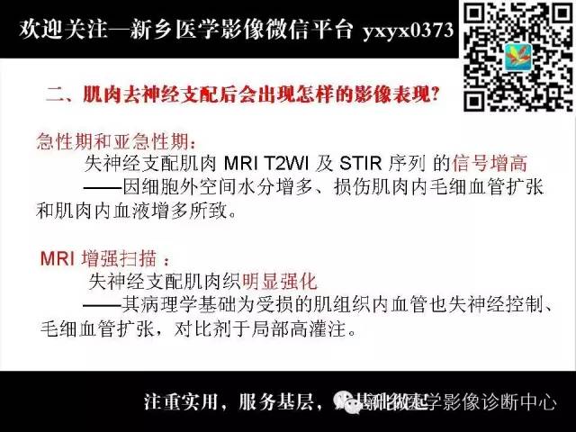 【PPT】肌肉去神经支配的影像表现