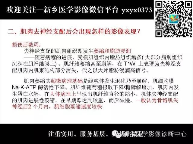 【PPT】肌肉去神经支配的影像表现