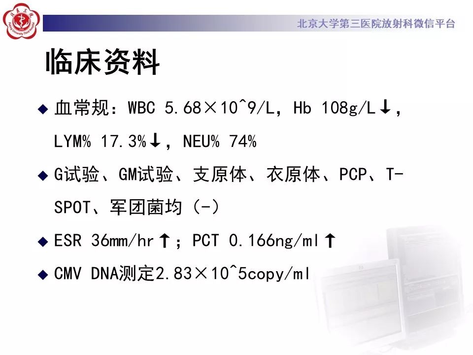 【病例】巨细胞病毒性肺炎1例CT影像