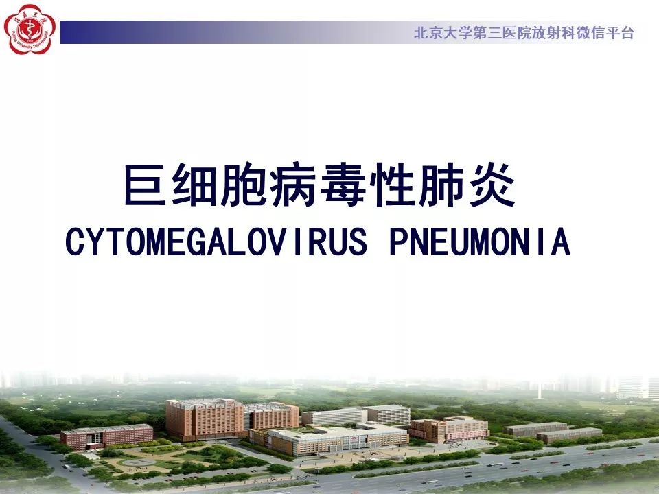 【病例】巨细胞病毒性肺炎1例CT影像