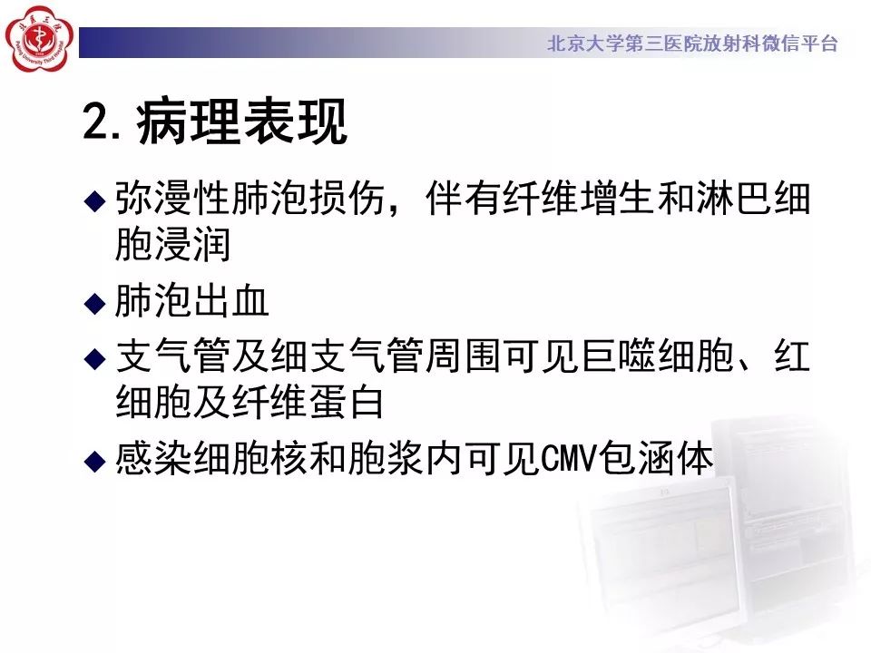 【病例】巨细胞病毒性肺炎1例CT影像