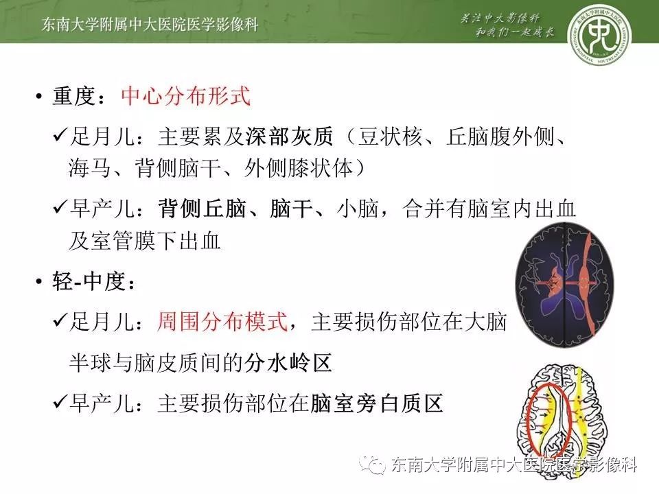 【病例】新生儿低血糖脑病2例MR影像