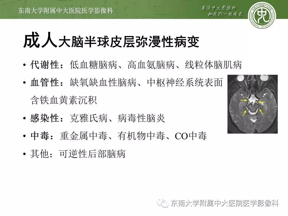 【病例】新生儿低血糖脑病2例MR影像