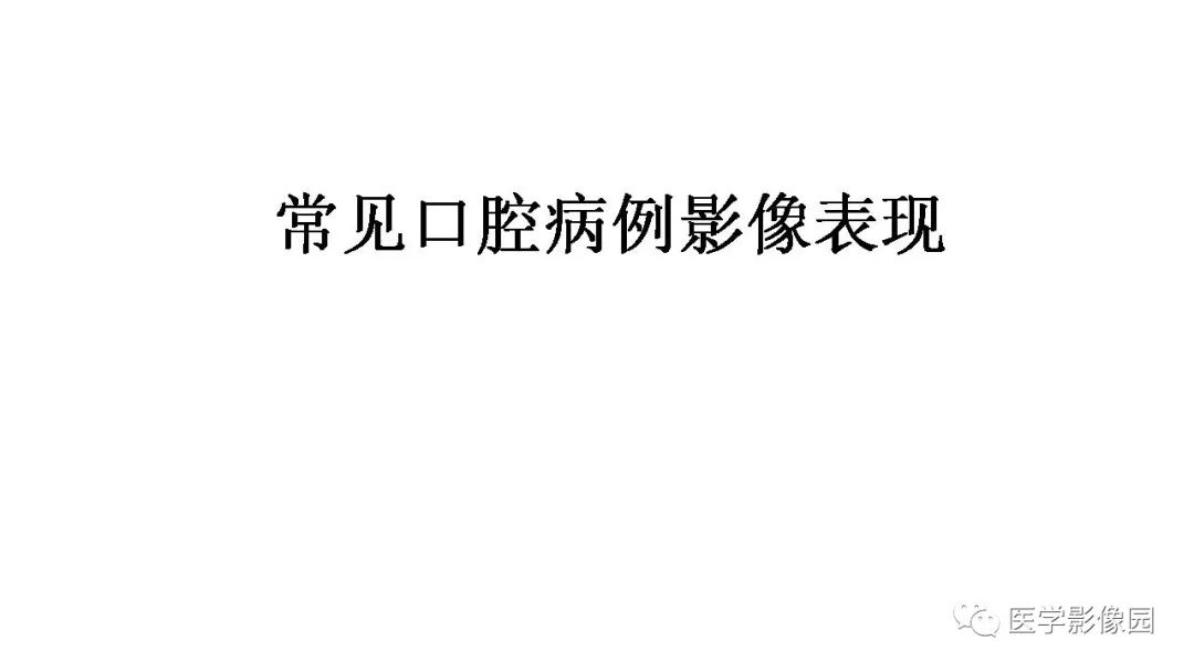 【PPT】常见口腔病例影像表现