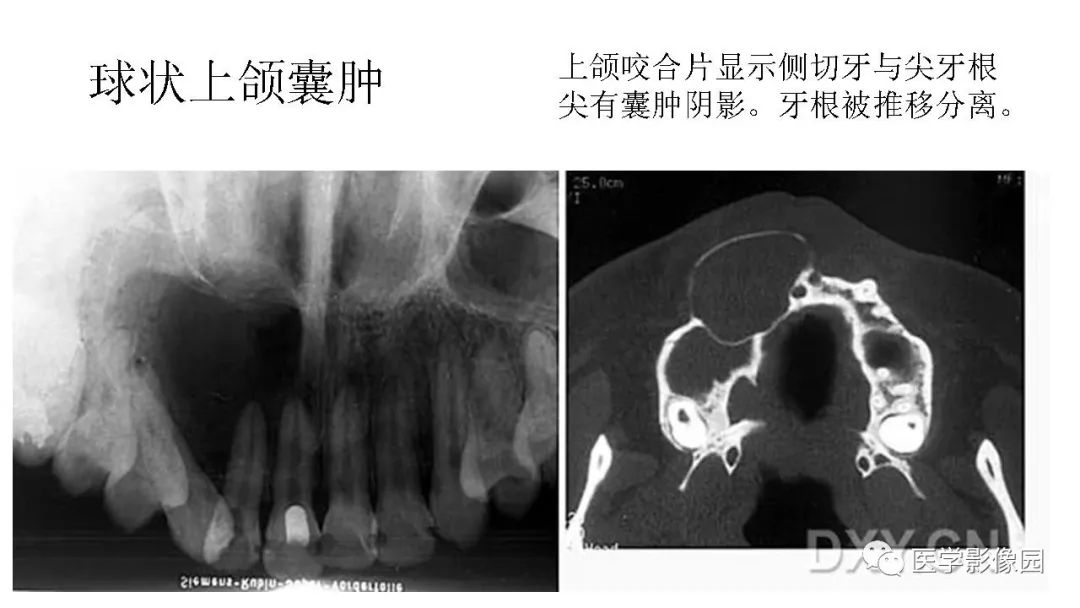 【PPT】常见口腔病例影像表现