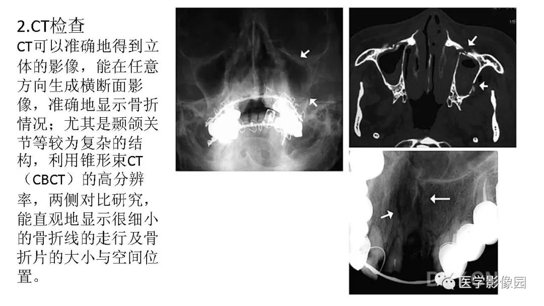 【PPT】常见口腔病例影像表现
