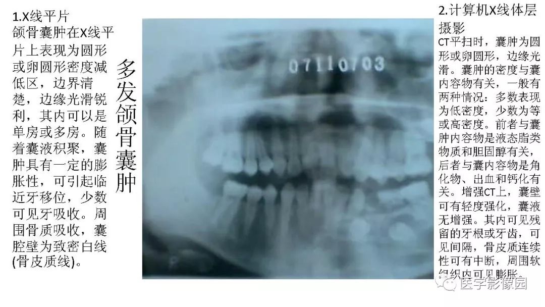 【PPT】常见口腔病例影像表现