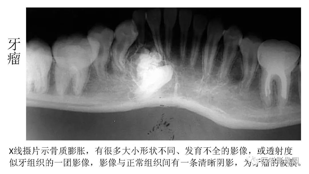 【PPT】常见口腔病例影像表现