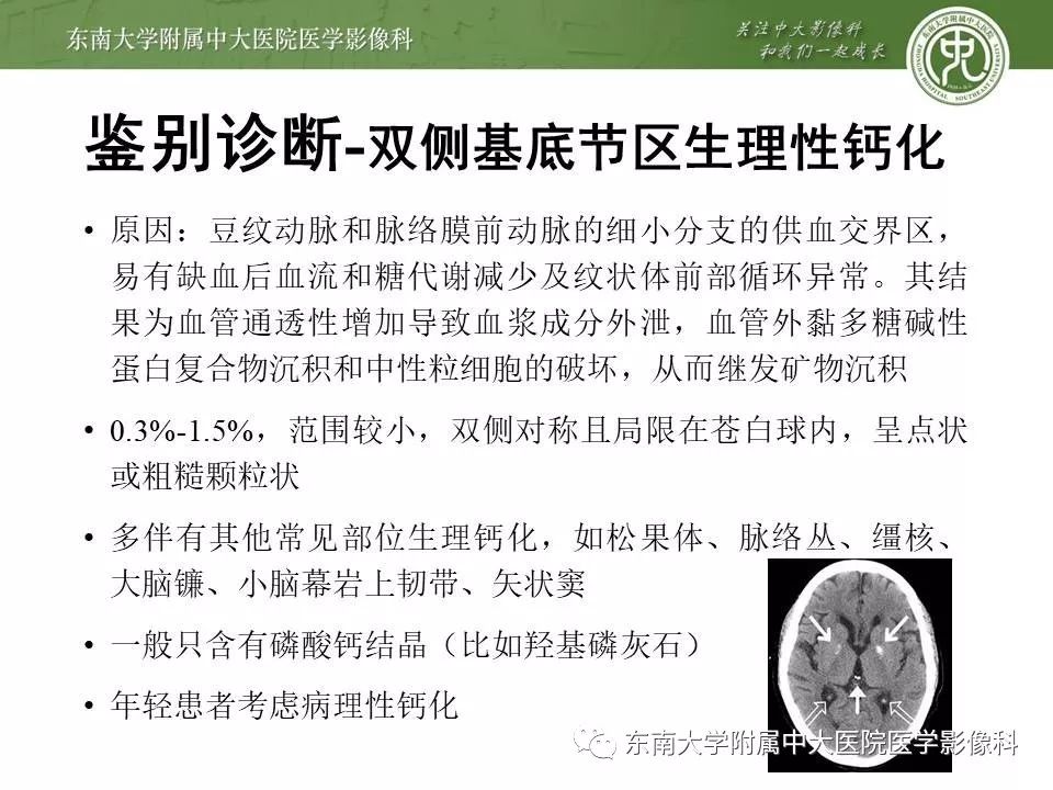 【病例】双侧基底节区脑出血 VS 造影剂渗出 各1例CT