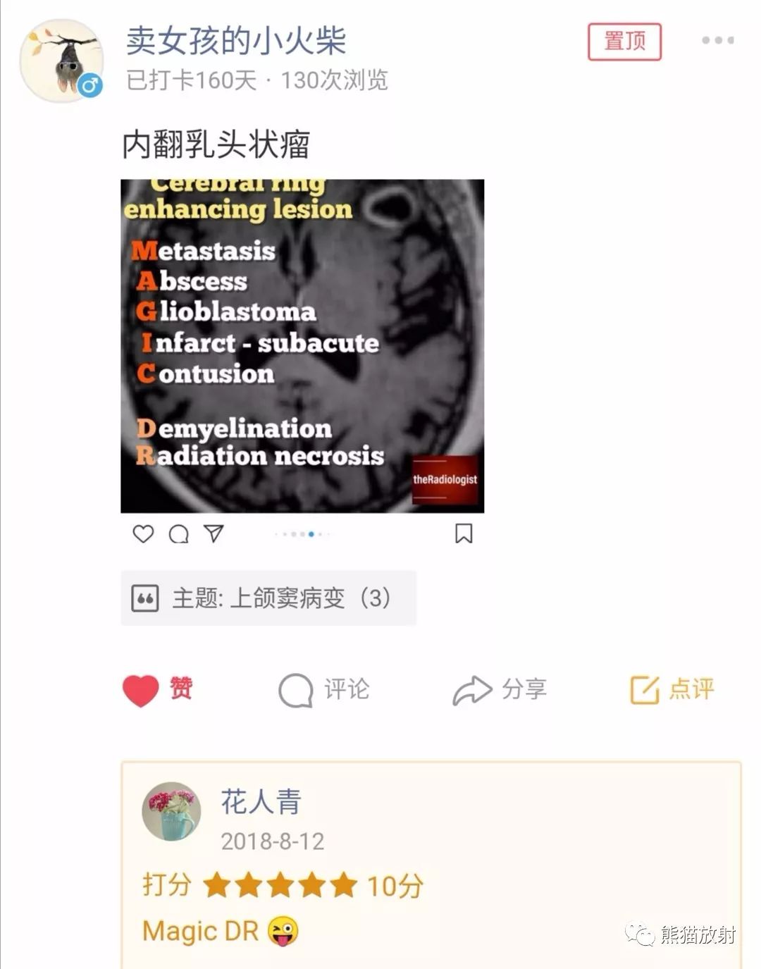 【病例】上颌窦内翻性乳头状瘤1例CT