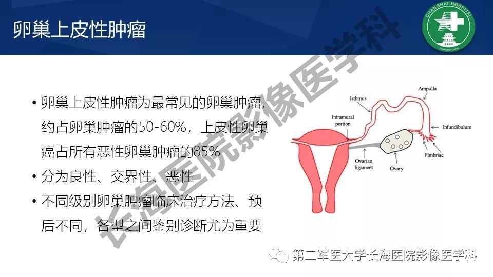 【PPT】卵巢上皮性肿瘤影像诊断